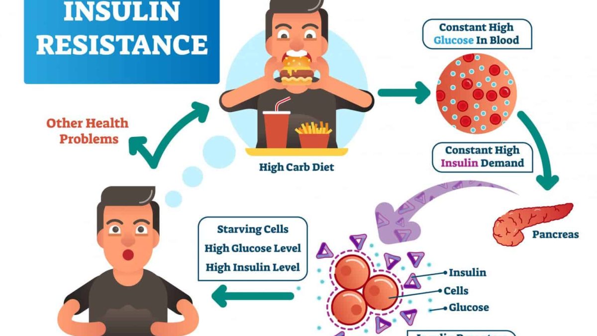 What-is-Insulin-Resistance-en