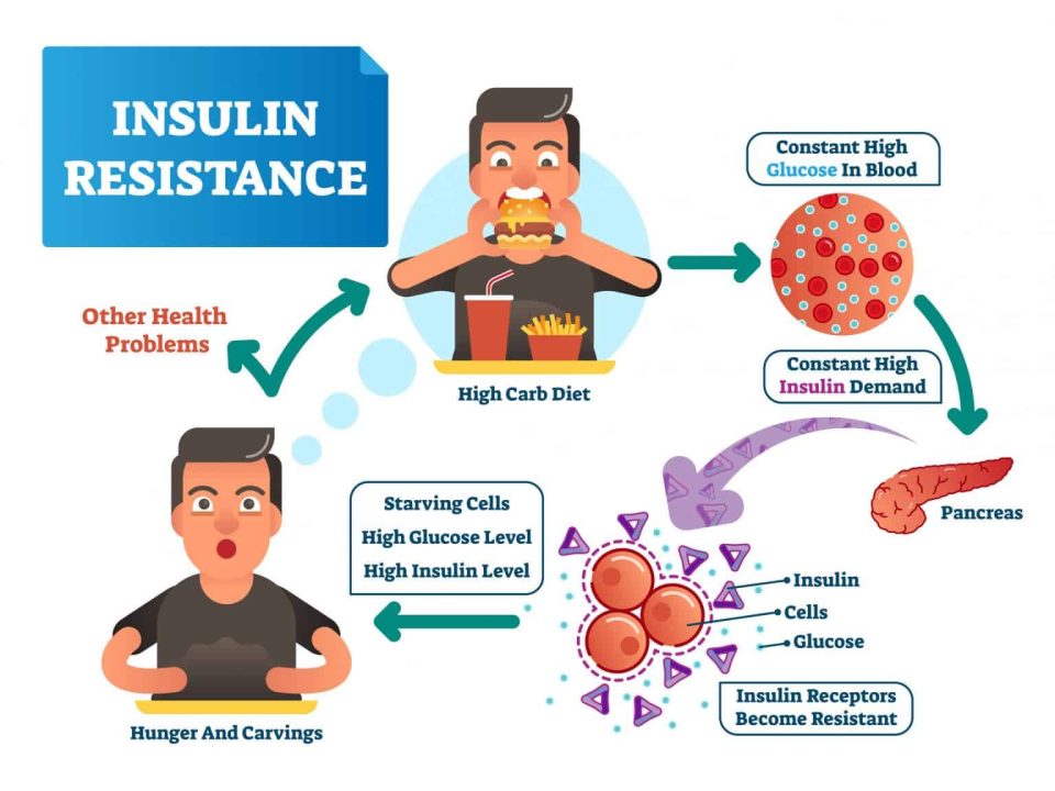 What-is-Insulin-Resistance-en